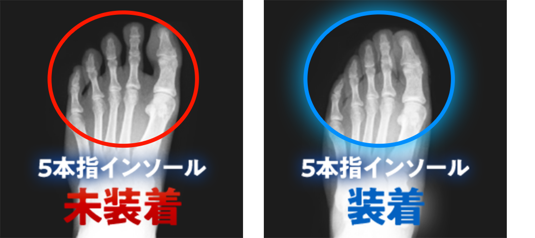 REVE（レーブ）5本指インソール