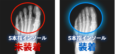 REVE（レーブ）5本指インソール