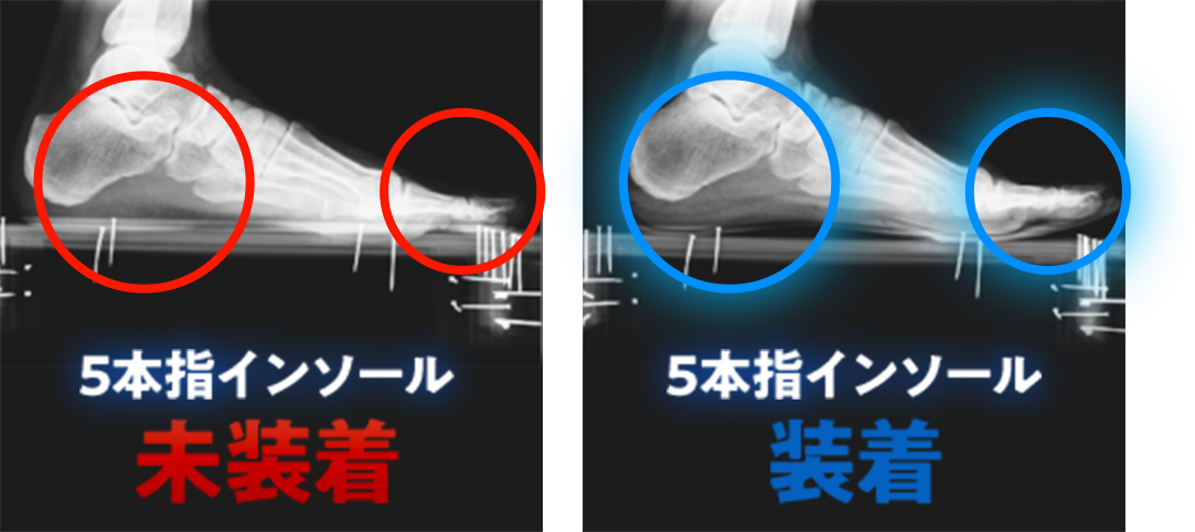 REVE（レーブ）5本指インソール