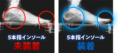 REVE（レーブ）5本指インソール
