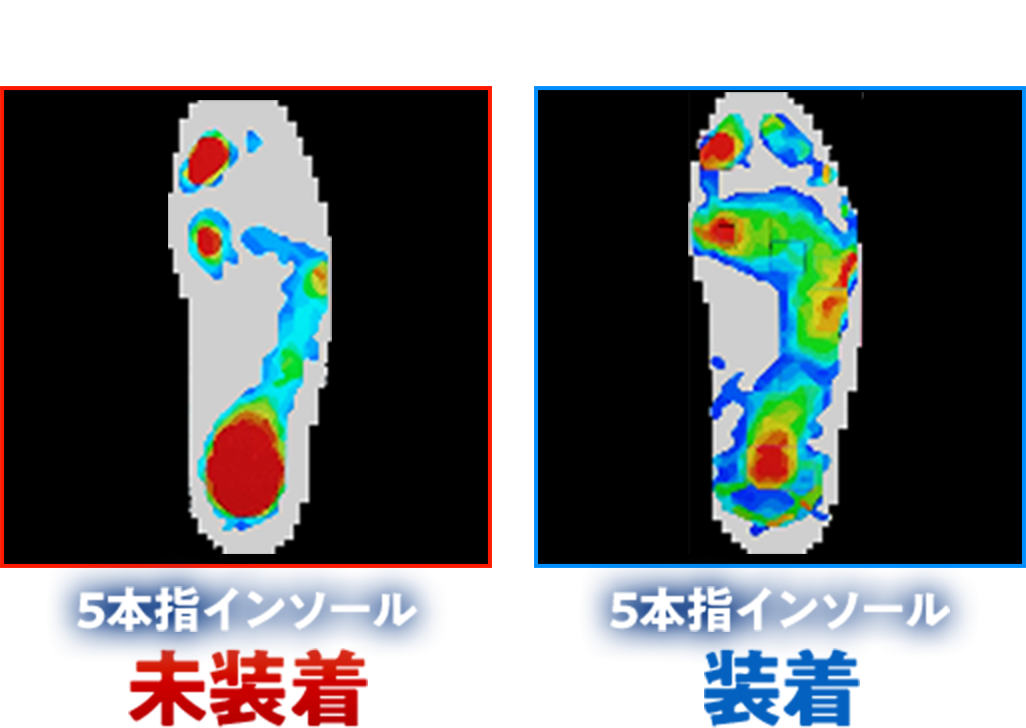 REVE（レーブ）5本指インソール