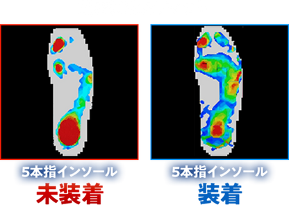 REVE（レーブ）5本指インソール