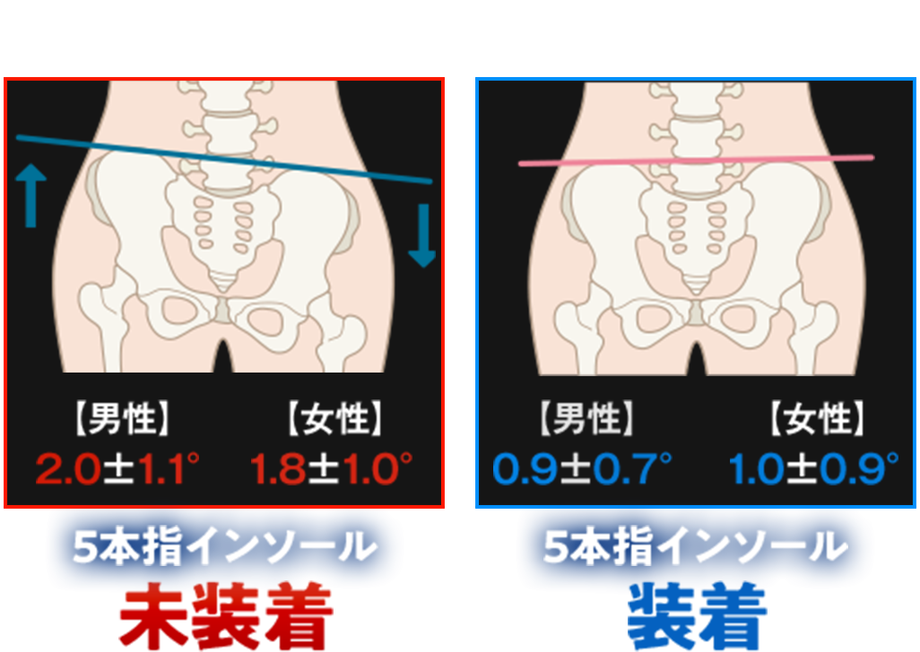 REVE（レーブ）5本指インソール